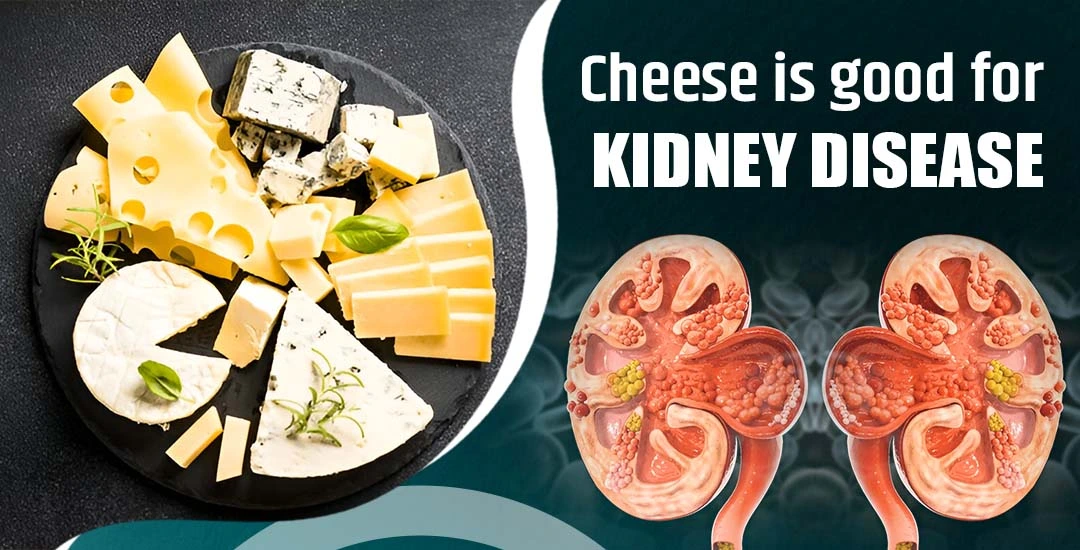Which Cheese is Good for Kidney Disease?